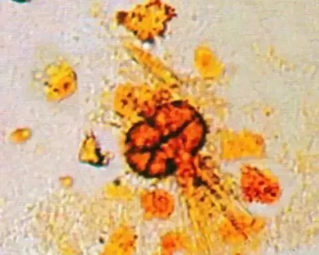 1749452709198769.jpg a3b7526dd0ac9dd8d43a551ee57271d2.jpg