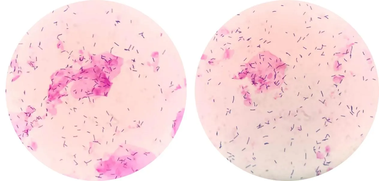 1750818951740357.jpg d84489f93192f967eb168a03caa477c8.jpg